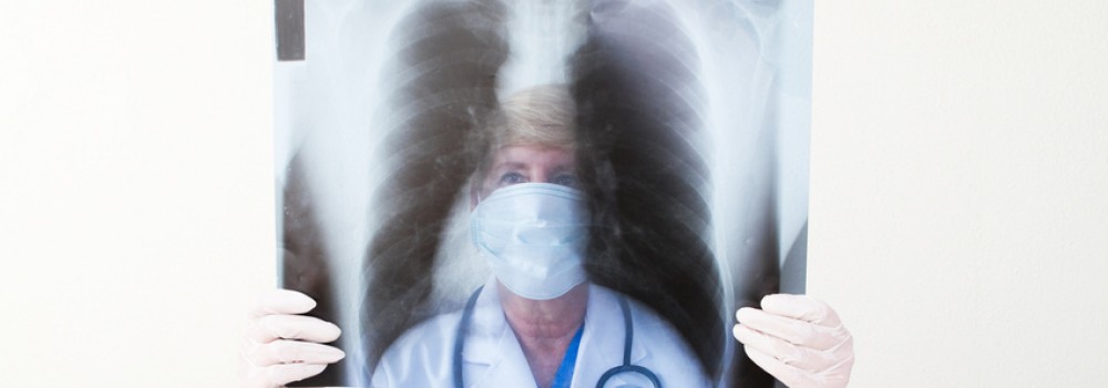 röntgenbild lunge